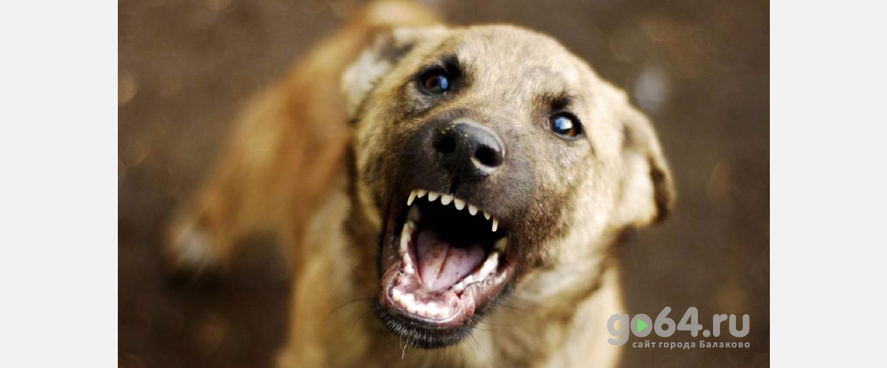 Укушенный собакой школьник в Балаково находится в больнице